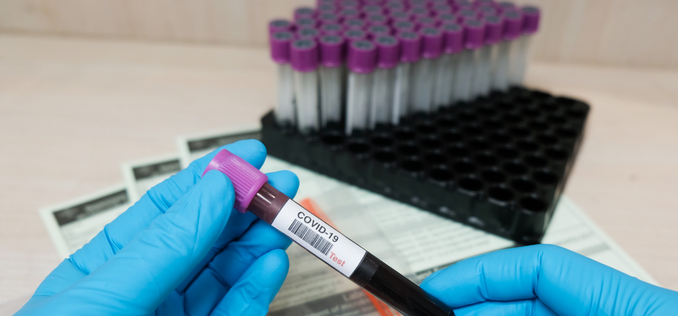 CEPI FUNDS PROJECT LED BY VIBRI (KENYA) TO ASSESS MIX-AND-MATCH COVID-19 VACCINE BOOSTERS IN ADOLESCENTS AND ADULTS LIVING WITH HIV